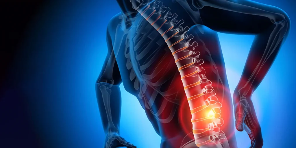 lower back pain illustration hero